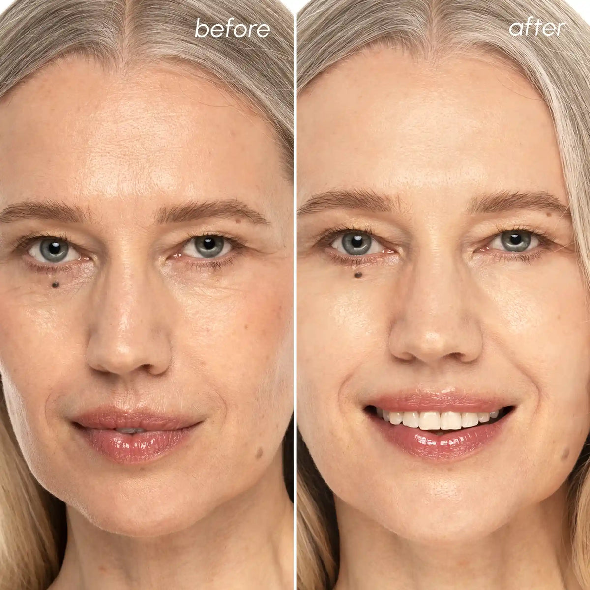 Collagen & Retinol